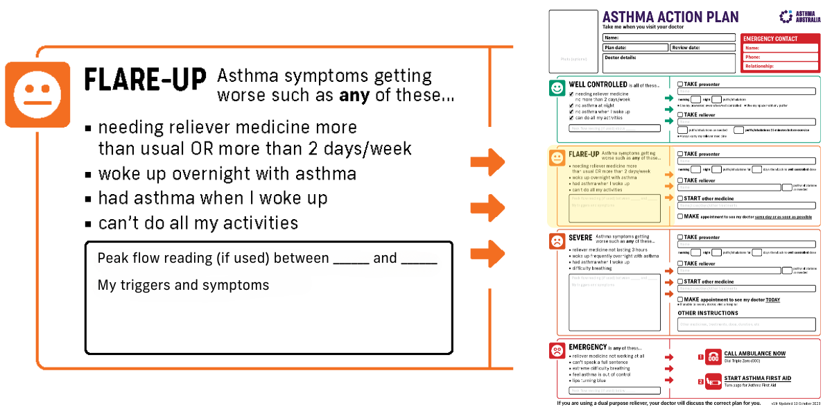 Flare up Asthma Action Plan zoomed